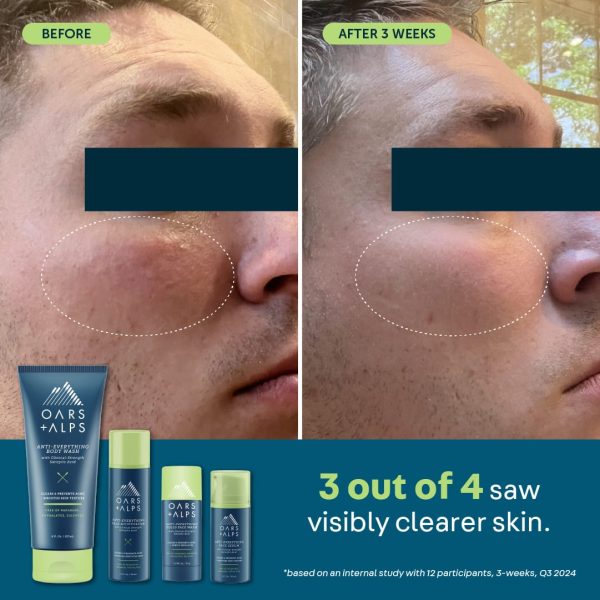 Anti-Everything Solid Face Wash For Cheap - Image 2